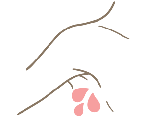 脇汗