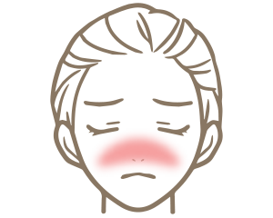 酒さ・赤ら顔